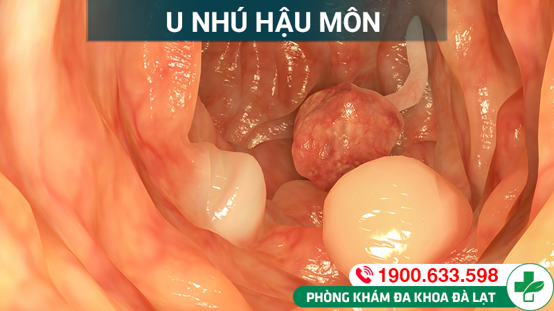 Hình ảnh minh họa